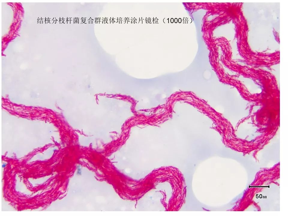 如何提高临床标本中抗酸杆菌涂片阳性率